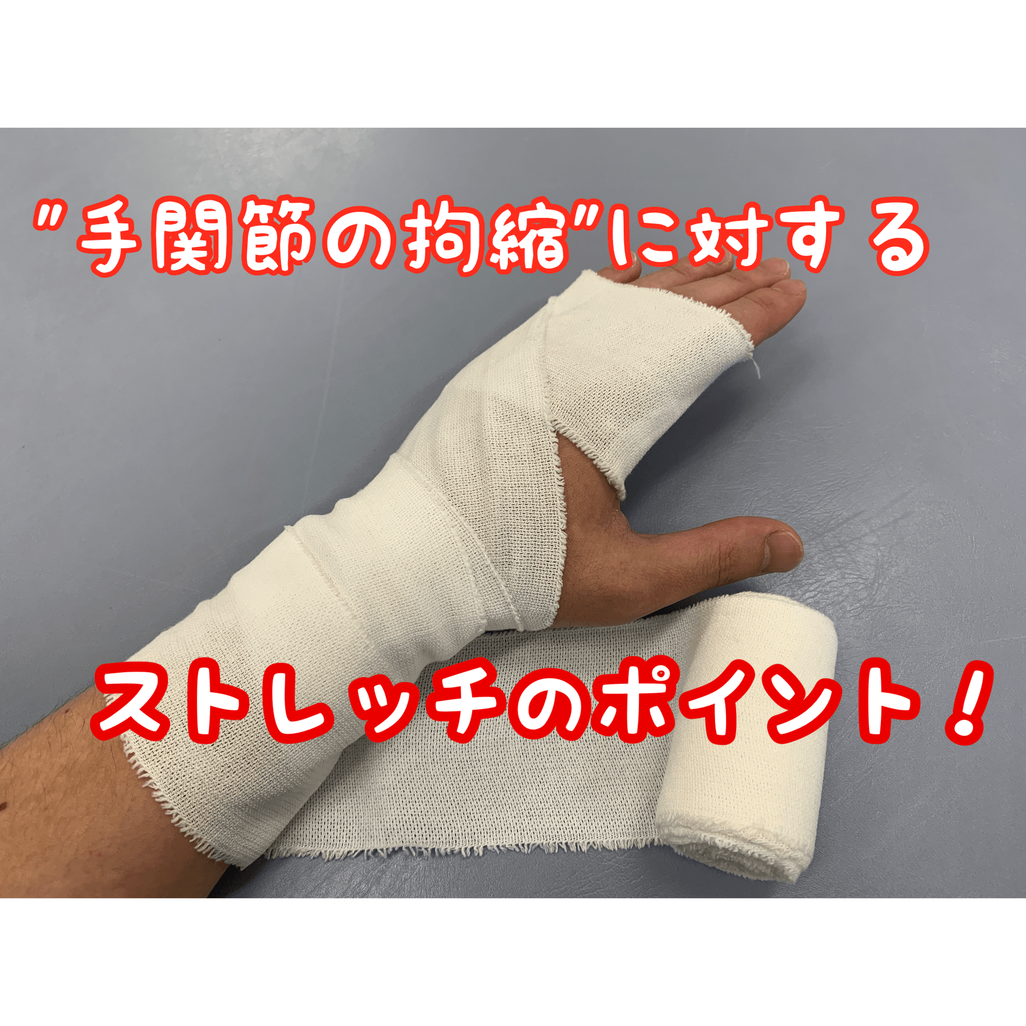 手関節の拘縮に対するストレッチのポイント！